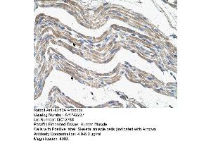 Rabbit Anti-IDH3A Antibody  Paraffin Embedded Tissue: Human Muscle Cellular Data: Skeletal muscle cells Antibody Concentration: 4. (IDH3A antibody  (N-Term))