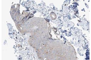ABIN6266983 at 1/100 staining human skin tissue sections by IHC-P. (MAST4 antibody  (N-Term))