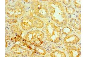 Immunohistochemistry of paraffin-embedded human kidney tissue using ABIN7154304 at dilution of 1:100 (GORASP1 antibody  (AA 221-440))