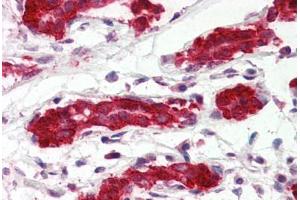 Human Breast (formalin-fixed, paraffin-embedded) stained with PDCD4 antibody ABIN364343 at 5 ug/ml followed by biotinylated anti-mouse IgG secondary antibody ABIN481714, alkaline phosphatase-streptavidin and chromogen. (PDCD4 antibody  (AA 1-469))