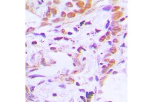Immunohistochemistry (IHC) image for anti-Transcription Factor 7 (T-Cell Specific, HMG-Box) (TCF7) (N-Term) antibody (ABIN7297092)