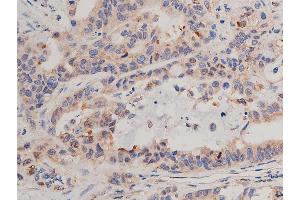 Immunohistochemistry (IHC) image for anti-Nuclear Factor of kappa Light Polypeptide Gene Enhancer in B-Cells Inhibitor, alpha (NFKBIA) (N-Term) antibody (ABIN6262504)