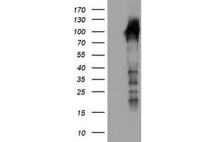 HEK293T cells were transfected with the pCMV6-ENTRY control (Left lane) or pCMV6-ENTRY LRRC50 (Right lane) cDNA for 48 hrs and lysed. (LRRC50 antibody)