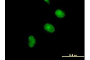 Immunofluorescence of purified MaxPab antibody to CDCA5 on HeLa cell. (CDCA5 antibody  (AA 1-252))