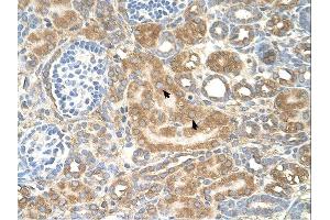 SPTLC1 antibody was used for immunohistochemistry at a concentration of 4-8 ug/ml. (SPTLC1 antibody  (Middle Region))