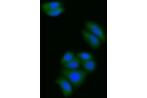 Detection of S100A6 in Human MCF7 cell using Polyclonal Antibody to S100 Calcium Binding Protein A6 (S100A6) (S100A6 antibody  (AA 1-90))