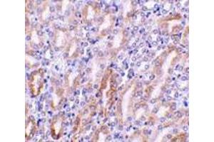 Immunohistochemistry of CAD in mouse kidney tissue with CAD antibody at 1 μg/ml. (DFFB antibody  (C-Term))