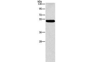 Western Blot analysis of Human lung cancer tissue using CALCRL Polyclonal Antibody at dilution of 1:550 (CALCRL antibody)