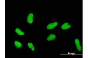 Immunofluorescence of purified MaxPab antibody to DR1 on HeLa cell. (DR1 antibody  (AA 1-176))