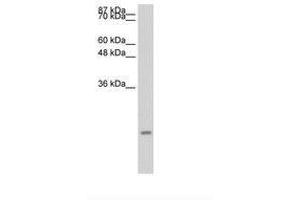 Image no. 1 for anti-Chemokine (C-C Motif) Ligand 13 (CCL13) (C-Term) antibody (ABIN6736685) (CCL13 antibody  (C-Term))