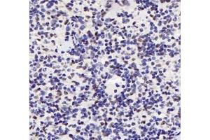Immunohistochemistry (Paraffin-embedded Sections) (IHC (p)) image for anti-Adrenergic, alpha-1B-, Receptor (ADRA1B) antibody (ABIN7072974)