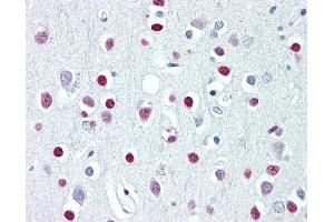 Anti-WHSC1 / NSD2 antibody IHC of human brain, cortex. (WHSC1 antibody  (AA 219-268))