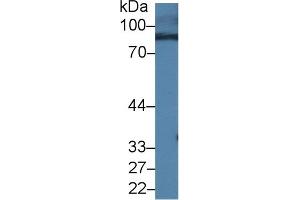 Detection of RALBP1 in Mouse Serum using Polyclonal Antibody to RalA Binding Protein 1 (RALBP1) (RALBP1 antibody  (AA 192-380))