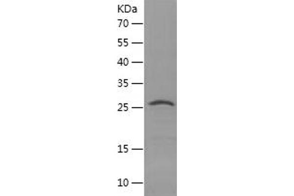 TFAM Protein (AA 43-246) (His tag)