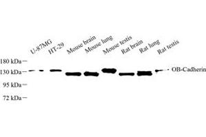 Western blot analysis of OB-Cadherin (ABIN7073255) at dilution of 1: 500 (OB Cadherin antibody)