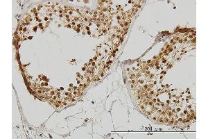 Immunoperoxidase of monoclonal antibody to IRAK1 on formalin-fixed paraffin-embedded human testis. (IRAK1 antibody  (AA 530-693))