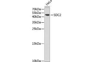 Western blot analysis of extracts of HeLa cells, using SDC2 antibody (ABIN3022587, ABIN3022588, ABIN3022589 and ABIN6218928) at 1:1000 dilution. (Syndecan 2 antibody  (AA 19-144))