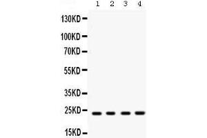Western blot analysis of Rab9 expression in rat brain extract (lane 1), mouse brain extract (lane 2), HELA whole cell lysates (lane 3) and MCF-7 whole cell lysates (lane 4). (RAB9A antibody  (C-Term))