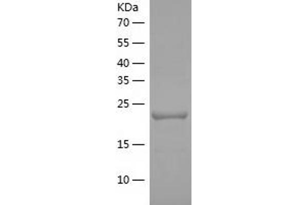 ADPRHL1 Protein (AA 29-258) (His tag)