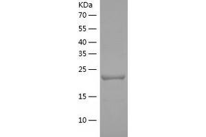 Western Blotting (WB) image for ADP-Ribosylhydrolase Like 1 (ADPRHL1) (AA 29-258) protein (His tag) (ABIN7287966) (ADPRHL1 Protein (AA 29-258) (His tag))