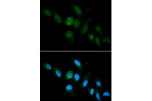 Immunofluorescence analysis of U2OS cell using HLA-A antibody. (HLA-A antibody  (AA 35-285))