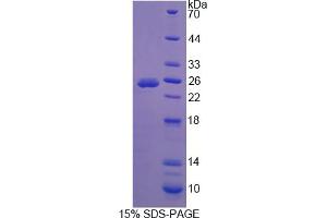 Image no. 1 for Ataxin 10 (ATXN10) (AA 116-302) protein (His tag) (ABIN6237900) (Ataxin 10 Protein (ATXN10) (AA 116-302) (His tag))