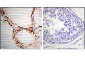 Immunohistochemistry analysis of paraffin-embedded human testis tissue, using MCM4 (Ab-54) Antibody. (MCM4 antibody  (AA 20-69))