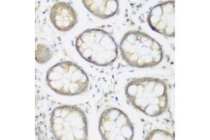 Immunohistochemistry of paraffin-embedded human colon using NFU1 antibody at dilution of 1:200 (40x lens). (NFU1 antibody)