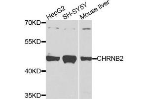 Western blot analysis of extracts of various cells, using CHRNB2 antibody. (CHRNB2 antibody)