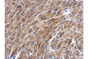 IHC-P Image Immunohistochemical analysis of paraffin-embedded U87 xenograft, using BAG2, antibody at 1:500 dilution. (BAG2 antibody)