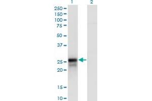 Western Blot analysis of DIRAS2 expression in transfected 293T cell line by DIRAS2 polyclonal antibody (A01). (DIRAS2 antibody  (AA 81-180))