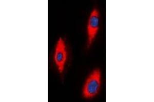 ZNRF2 antibody  (C-Term)