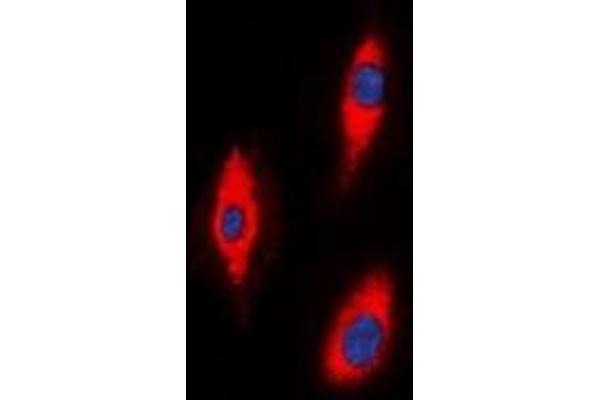 ZNRF2 antibody  (C-Term)