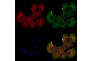 ABIN6261245 and ABIN6273225 staining Hela cells by IF/ICC. (DCTN6 antibody  (Internal Region))