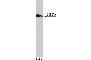 Western blot analysis of PKR on a A431 cell lysate (Human epithelial carcinoma, ATCC CRL-1555). (EIF2AK2 antibody  (AA 117-250))