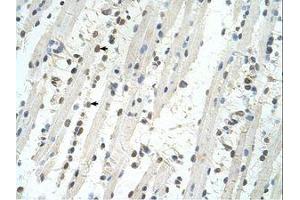 Image no. 1 for anti-Tripartite Motif Containing 32 (TRIM32) (AA 559-608) antibody (ABIN324509) (TRIM32 antibody  (AA 559-608))