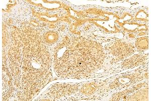 ABIN6261610 and ABIN6269080 at 1/100 staining Rat ovary tissue by IHC-P.