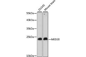 Western blot analysis of extracts of various cell lines, using MED20 antibody (ABIN7268441) at 1:1000 dilution. (MED20 antibody  (AA 1-212))