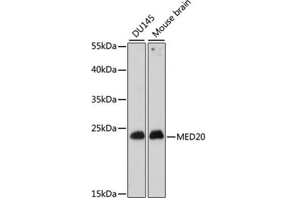 MED20 anticorps  (AA 1-212)