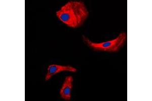 Immunofluorescent analysis of Kallikrein 3 staining in LNCaP cells. (Prostate Specific Antigen antibody  (Center))