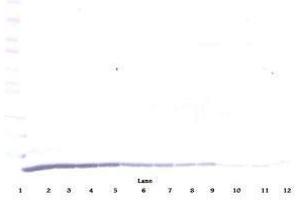 Image no. 1 for anti-Chemokine (C-C Motif) Ligand 22 (CCL22) antibody (ABIN465131) (CCL22 antibody)