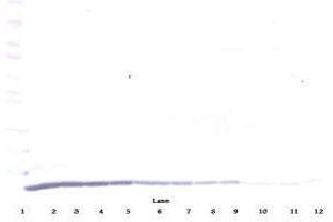 Image no. 1 for anti-Chemokine (C-C Motif) Ligand 22 (CCL22) antibody (ABIN465130) (CCL22 antibody)