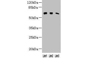 Western blot All lanes: KLHL23 antibody at 3 μg/mL Lane 1: Mouse lung tissue Lane 2: Human placenta tissue Lane 3: HL60 whole cell lysate Secondary Goat polyclonal to rabbit IgG at 1/10000 dilution Predicted band size: 64 kDa Observed band size: 64 kDa (KLHL23 antibody  (AA 1-200))