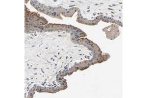 Immunohistochemical staining of human skeletal muscle with XYLT1 polyclonal antibody  shows moderate cytoplasmic positivity at 1:20-1:50 dilution. (XYLT1 antibody)