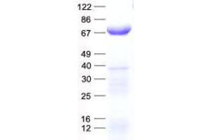 Validation with Western Blot (CCT4 Protein (His tag))