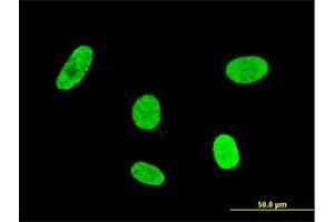 Immunofluorescence of monoclonal antibody to GSC on HeLa cell.