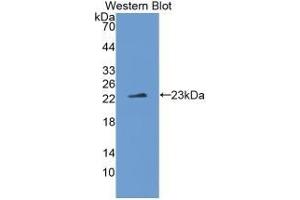 Detection of Recombinant IL1z, Human using Monoclonal Antibody to Interleukin 1 Zeta (IL1z) (IL-37 antibody  (AA 27-192))