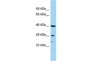 WB Suggested Anti-SBSN Antibody Titration: 1. (Suprabasin antibody  (Middle Region))