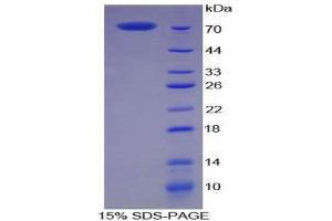 SDS-PAGE (SDS) image for Creatine Kinase, Muscle (CKM) (AA 11-367) protein (His tag,GST tag) (ABIN2122711)
