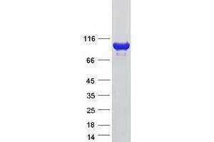 Western Blotting (WB) image for Actinin, alpha 2 (ACTN2) protein (Myc-DYKDDDDK Tag) (ABIN2714613)